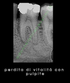Endodonzia